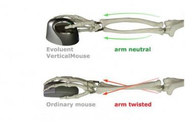 Ergonomic mouse: paglalarawan, katangian, larawan